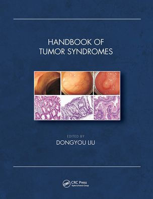 Handbook of Tumor Syndromes