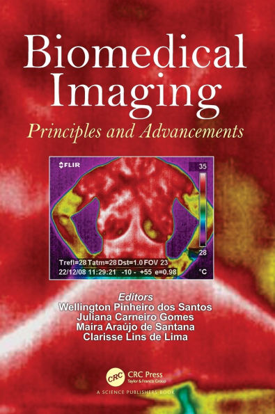 Biomedical Imaging: Principles and Advancements