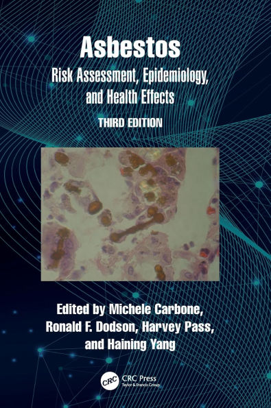 Asbestos: Risk Assessment, Epidemiology, and Health Effects