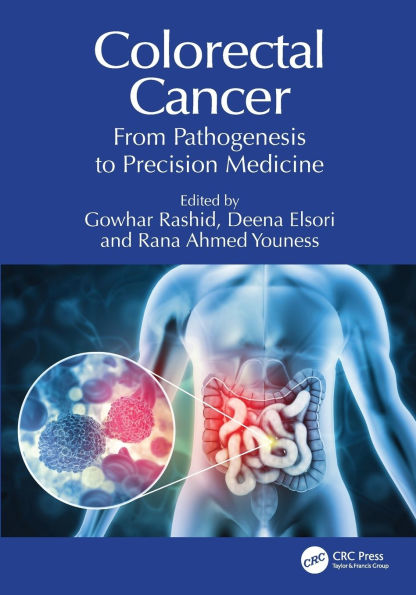 Colorectal Cancer: From Pathogenesis to Precision Medicine