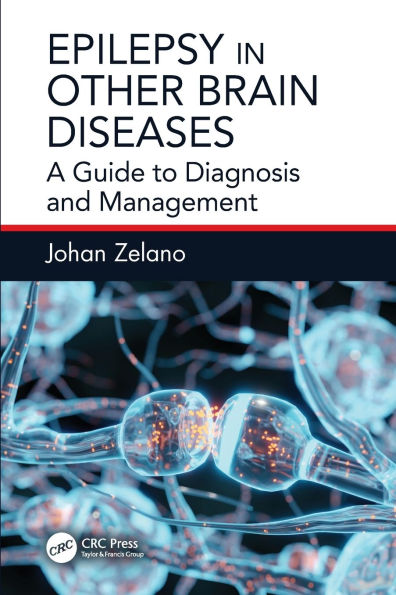 Epilepsy Other Brain Diseases: A Guide to Diagnosis and Management