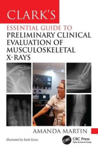 Title: Clark's Essential Guide to Preliminary Clinical Evaluation of Musculoskeletal X-rays, Author: Amanda Martin