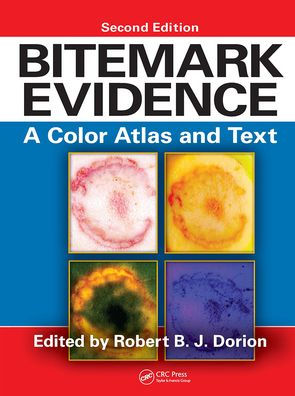 Bitemark Evidence: A Color Atlas and Text, 2nd Edition