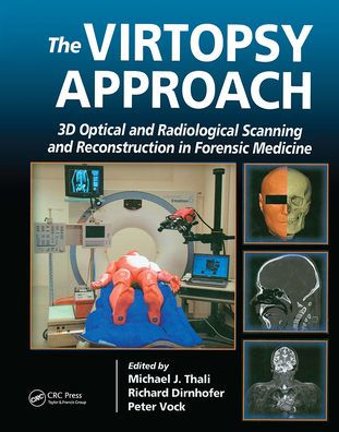 The Virtopsy Approach: 3D Optical and Radiological Scanning and Reconstruction in Forensic Medicine