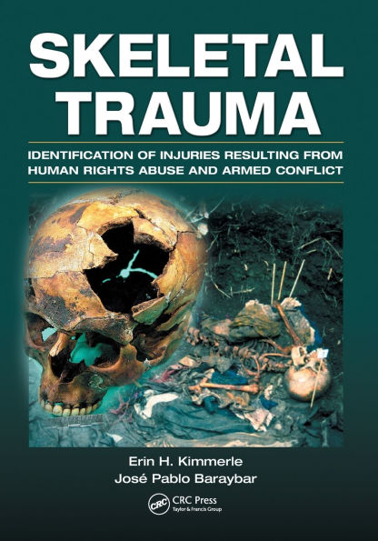 Skeletal Trauma: Identification of Injuries Resulting from Human Rights Abuse and Armed Conflict