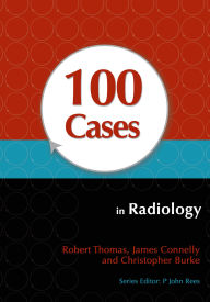 Title: 100 Cases in Radiology, Author: Robert Thomas