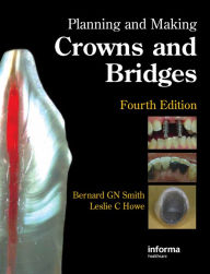 Title: Planning and Making Crowns and Bridges, Author: Bernard G.N. Smith