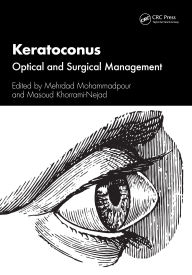 Title: Keratoconus: Optical and Surgical Management, Author: Mehrdad Mohammadpour