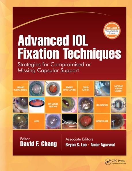 Advanced IOL Fixation Techniques: Strategies for Compromised or Missing Capsular Support
