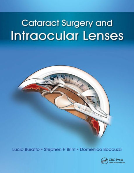 Cataract Surgery and Intraocular Lenses