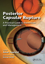 Title: Posterior Capsular Rupture: A Practical Guide to Prevention and Management, Author: Amar Agarwal