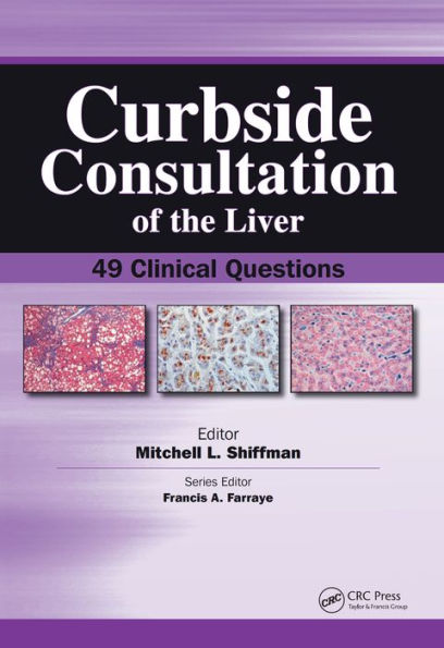 Curbside Consultation of the Liver: 49 Clinical Questions