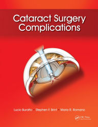 Title: Cataract Surgery Complications, Author: Lucio Buratto