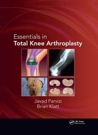 Title: Essentials in Total Knee Arthroplasty, Author: Javad Parvizi