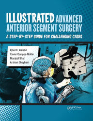 Title: Illustrated Advanced Anterior Segment Surgery: A Step-by-Step Guide for Challenging Cases, Author: Iqbal Ahmed