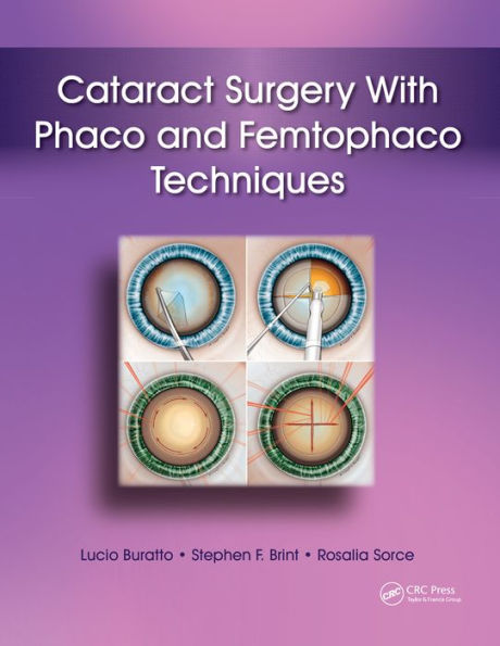 Cataract Surgery With Phaco and Femtophaco Techniques