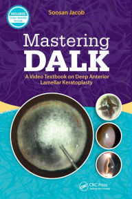 Title: Mastering DALK: A Video Textbook on Deep Anterior Lamellar Keratoplasty, Author: Soosan Jacob