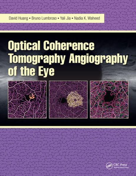 Optical Coherence Tomography Angiography of the Eye: OCT Angiography