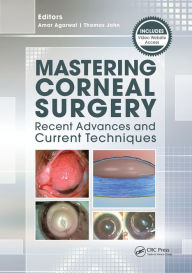 Title: Mastering Corneal Surgery: Recent Advances and Current Techniques, Author: Amar Agarwal