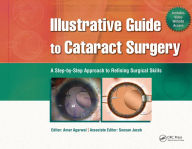 Title: Illustrative Guide to Cataract Surgery: A Step-by-Step Approach to Refining Surgical Skills, Author: Amar Agarwal