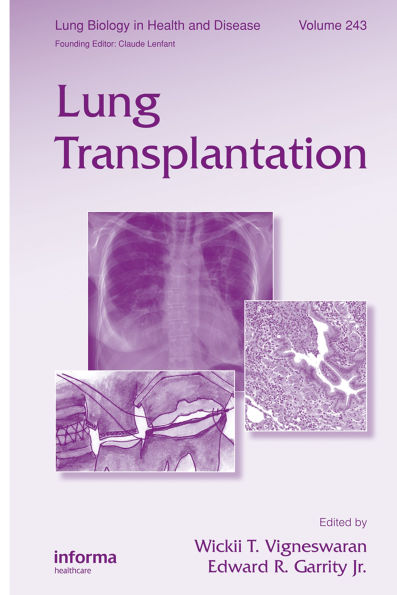 Lung Transplantation