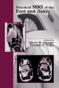 Title: Practical MRI of the Foot and Ankle, Author: Alison R. Spouge