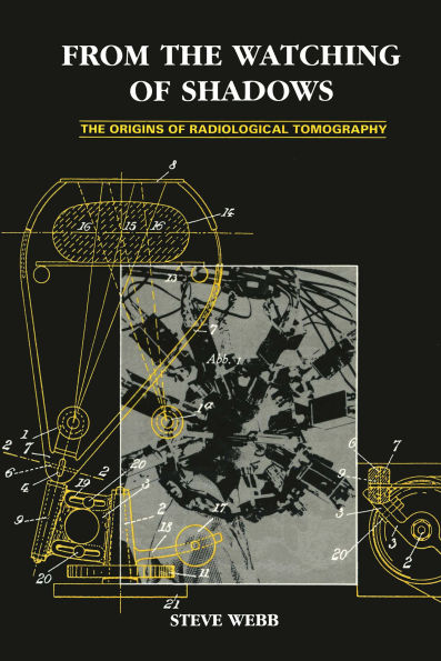 From the Watching of Shadows: The Origins of Radiological Tomography