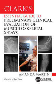 Title: Clark's Essential Guide to Preliminary Clinical Evaluation of Musculoskeletal X-rays, Author: Amanda Martin