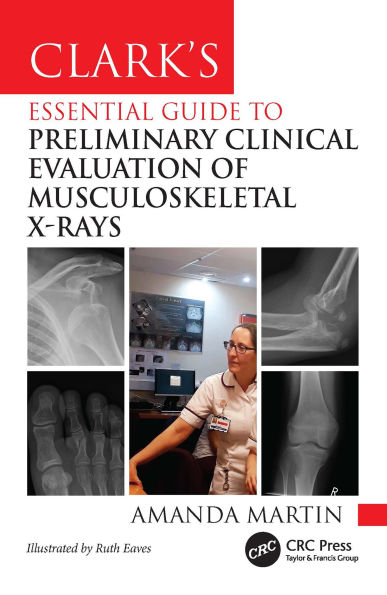 Clark's Essential Guide to Preliminary Clinical Evaluation of Musculoskeletal X-rays