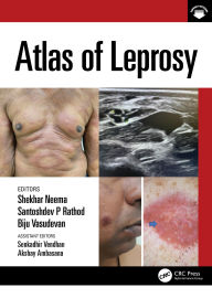 Best books download Atlas of Leprosy