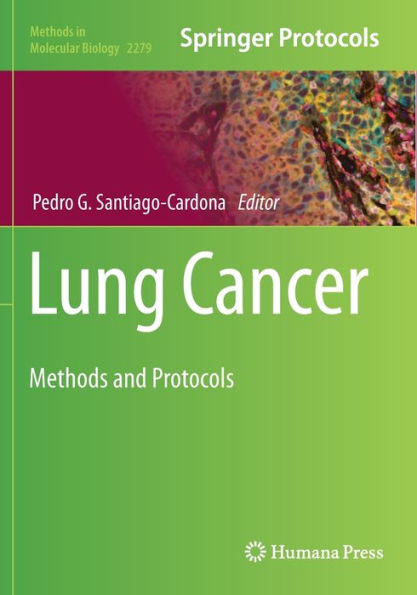 Lung Cancer: Methods and Protocols