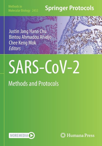 SARS-CoV-2: Methods and Protocols