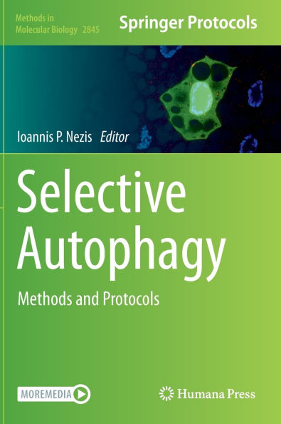 Selective Autophagy: Methods and Protocols