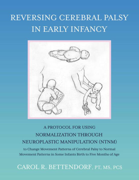 Reversing Cerebral Palsy in Early Infancy: A Protocol for Using Normalization Through Neuroplastic Manipulation (NTNM)