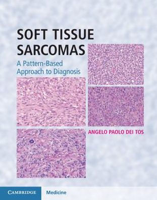 Soft Tissue Sarcomas Hardback with Online Resource: A Pattern-Based Approach to Diagnosis