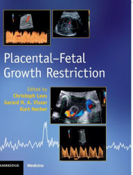 Title: Placental-Fetal Growth Restriction, Author: Christoph Lees