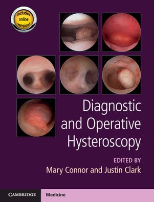 Diagnostic and Operative Hysteroscopy / Edition 1