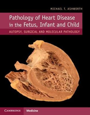 Pathology of Heart Disease in the Fetus, Infant and Child: Autopsy, Surgical and Molecular Pathology