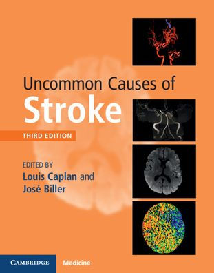 Uncommon Causes of Stroke / Edition 3
