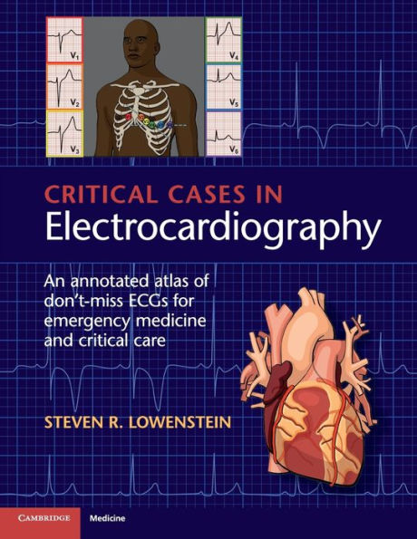 Critical Cases in Electrocardiography: An Annotated Atlas of Don't-Miss ECGs for Emergency Medicine and Critical Care