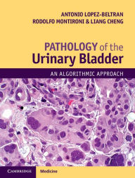 Free books download for nook Pathology of the Urinary Bladder: An Algorithmic Approach 9781107593374 by Antonio Lopez-Beltran, Rodolfo Montironi, Liang Cheng English version CHM iBook PDB