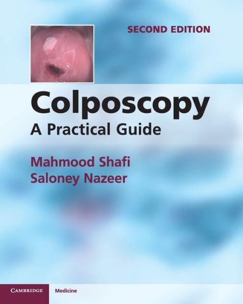 Colposcopy: A Practical Guide / Edition 2