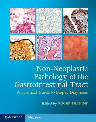 Non-Neoplastic Pathology of the Gastrointestinal Tract with Online Resource: A Practical Guide to Biopsy Diagnosis / Edition 1