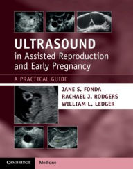 Title: Ultrasound in Assisted Reproduction and Early Pregnancy: A Practical Guide, Author: Jane S. Fonda