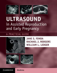 Title: Ultrasound in Assisted Reproduction and Early Pregnancy: A Practical Guide, Author: Jane S. Fonda