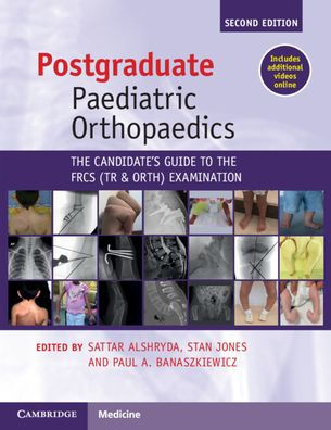 Postgraduate Paediatric Orthopaedics: The Candidate's Guide to the FRCS(Tr&Orth) Examination