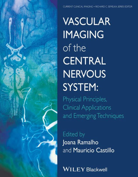 Vascular Imaging of the Central Nervous System: Physical Principles, Clinical Applications, and Emerging Techniques / Edition 1