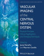 Vascular Imaging of the Central Nervous System: Physical Principles, Clinical Applications, and Emerging Techniques / Edition 1