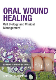 Title: Oral Wound Healing: Cell Biology and Clinical Management, Author: Hannu Larjava
