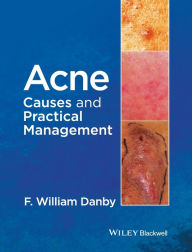 Title: Acne: Causes and Practical Management / Edition 1, Author: F. William Danby
